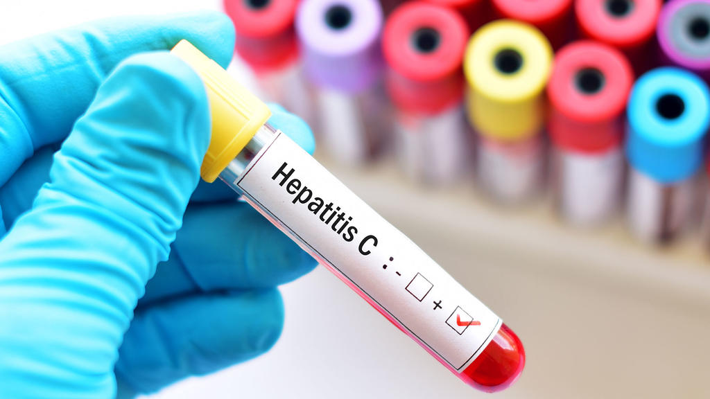El tratamiento de la hepatitis cuesta 93 mil pesos en promedio, señala aseguradora