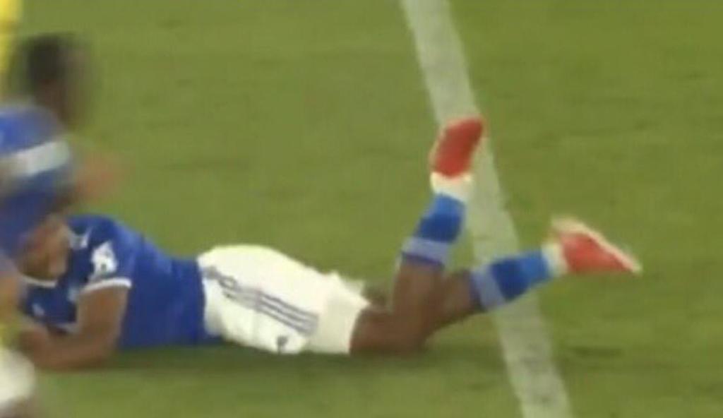 Wesley Fofana del Leicester City sufre impactante fractura durante amistoso