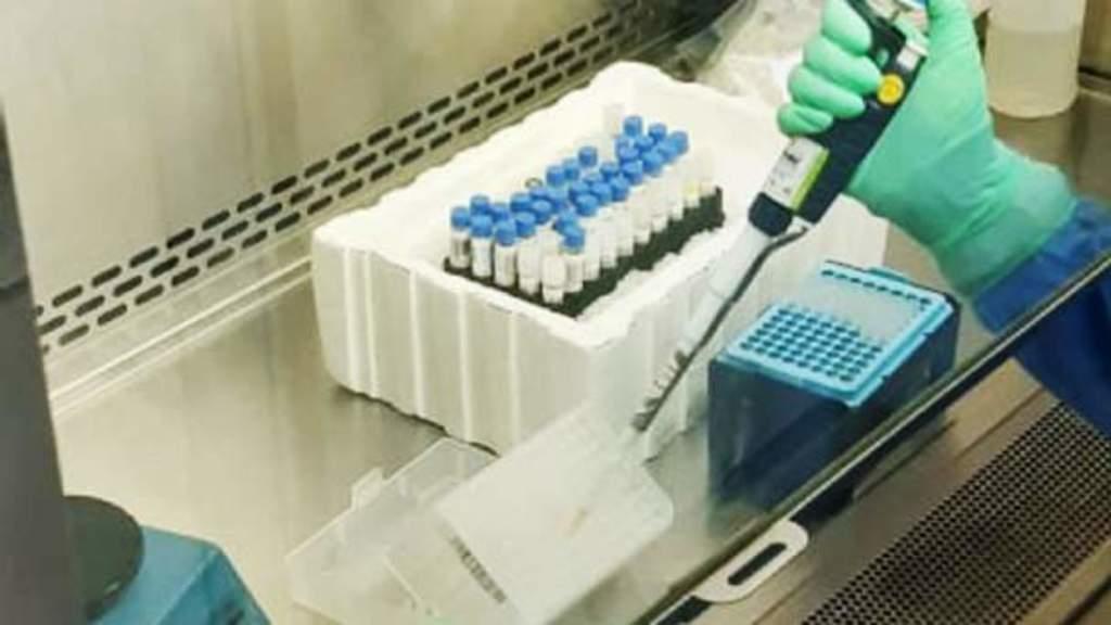Laboratorios de prueba COVID son saturados en Saltillo