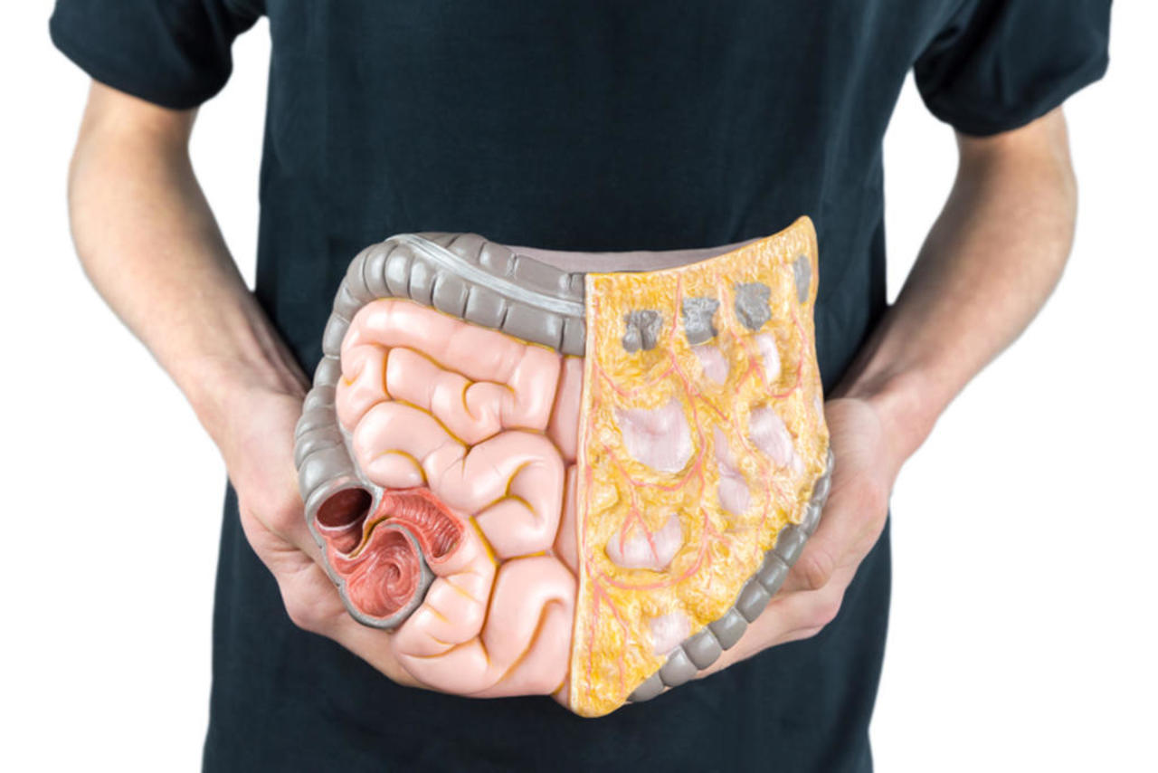 El microbioma intestinal marca la capacidad de las personas para adelgazar