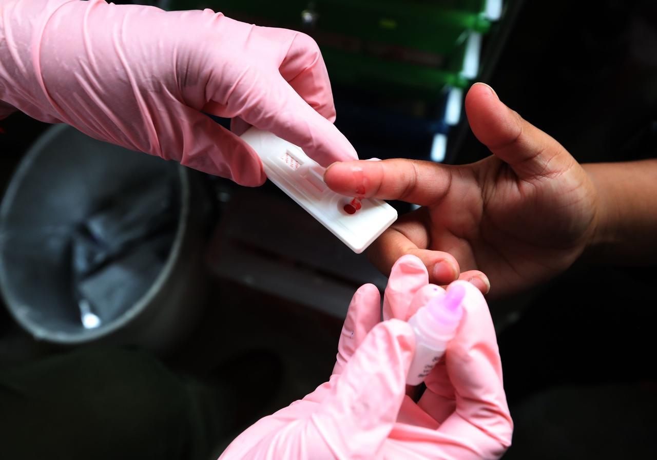 Inegi reporta baja en mortalidad por VIH en México