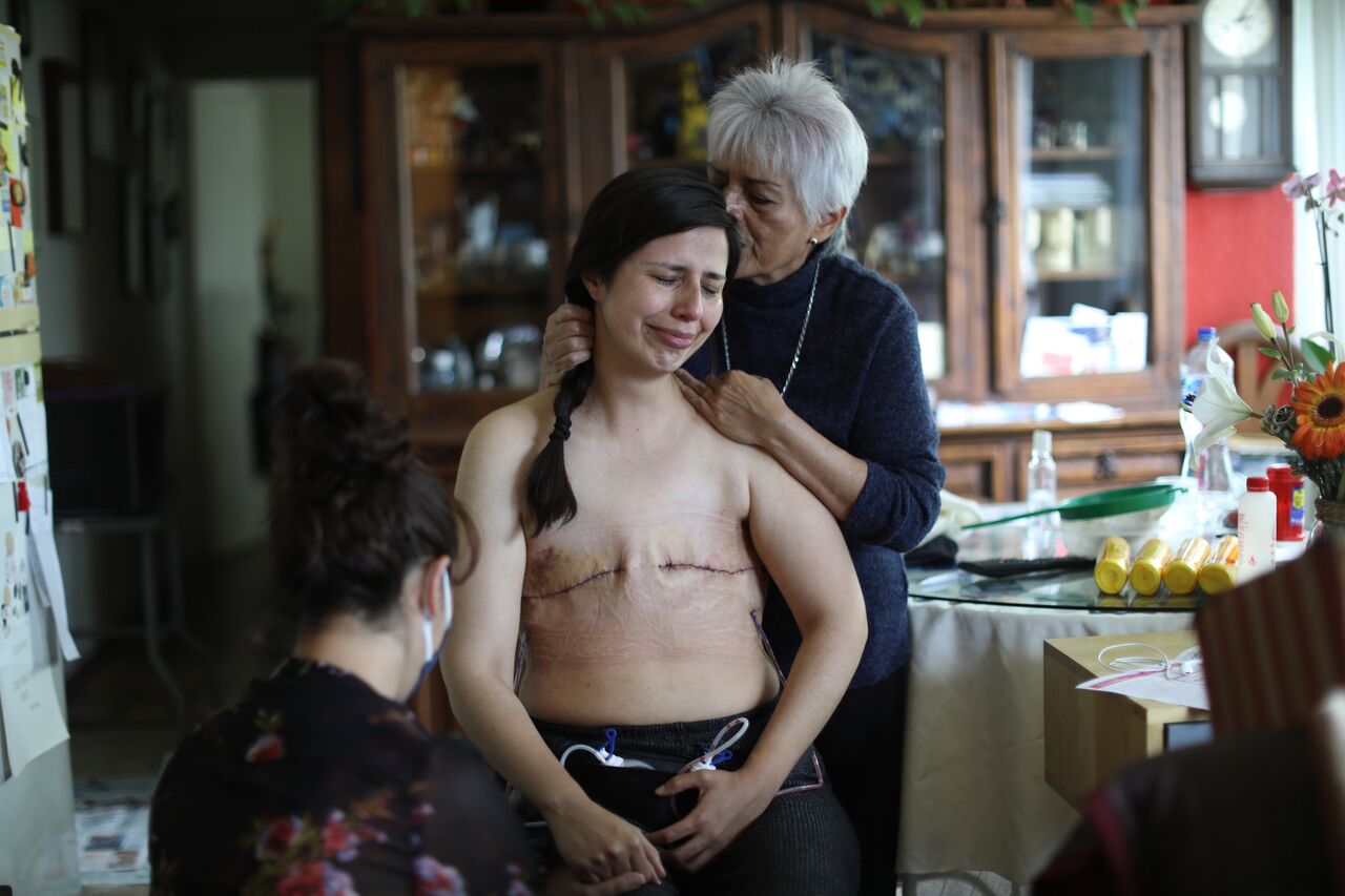Con fotografía del cáncer de mama, mexicana gana el premio Ortega y Gasset