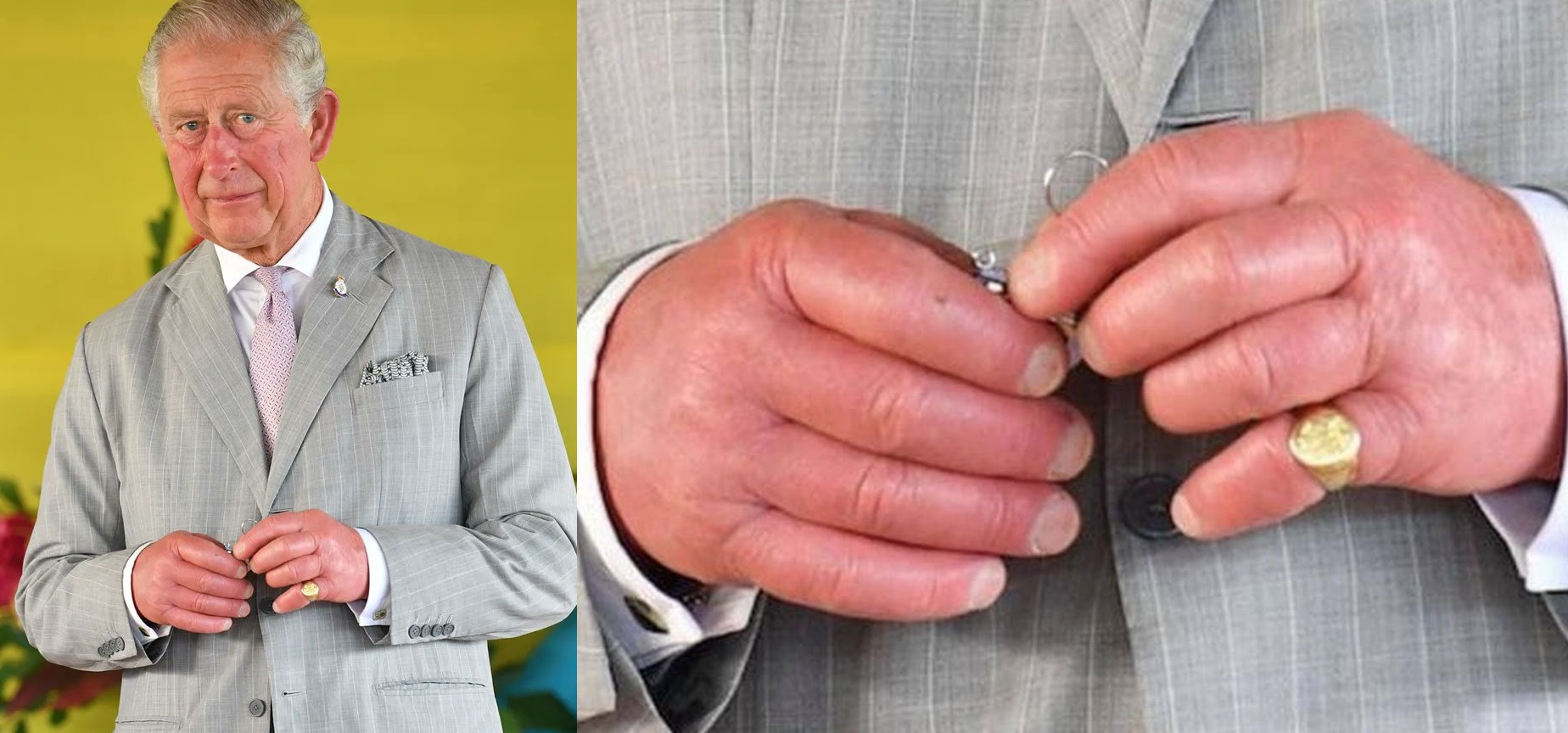 ¿Por qué el rey Carlos III tiene los dedos hinchados?