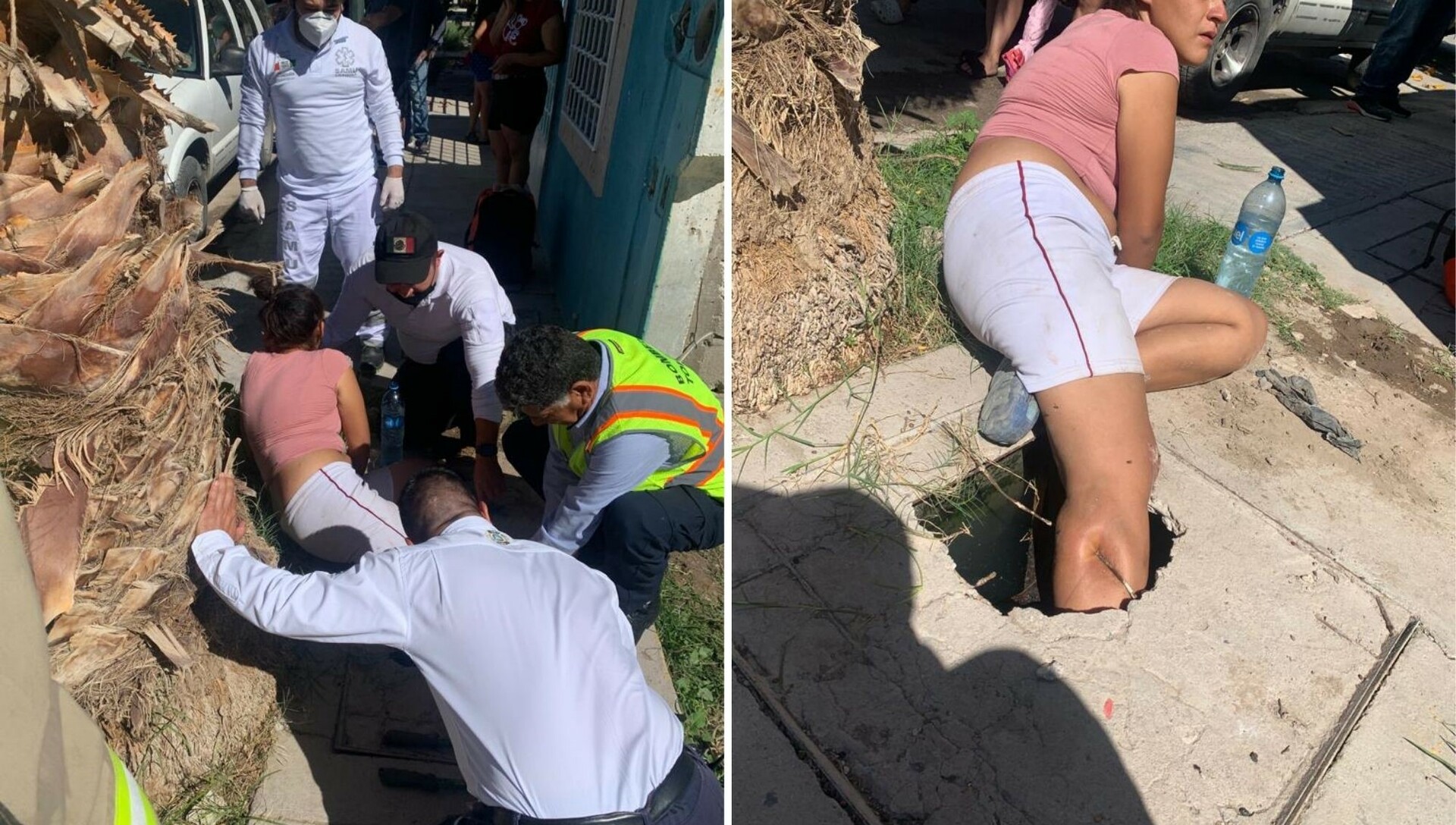 Varilla atraviesa pantorrilla de mujer tras caer en registro sanitario en Torreón