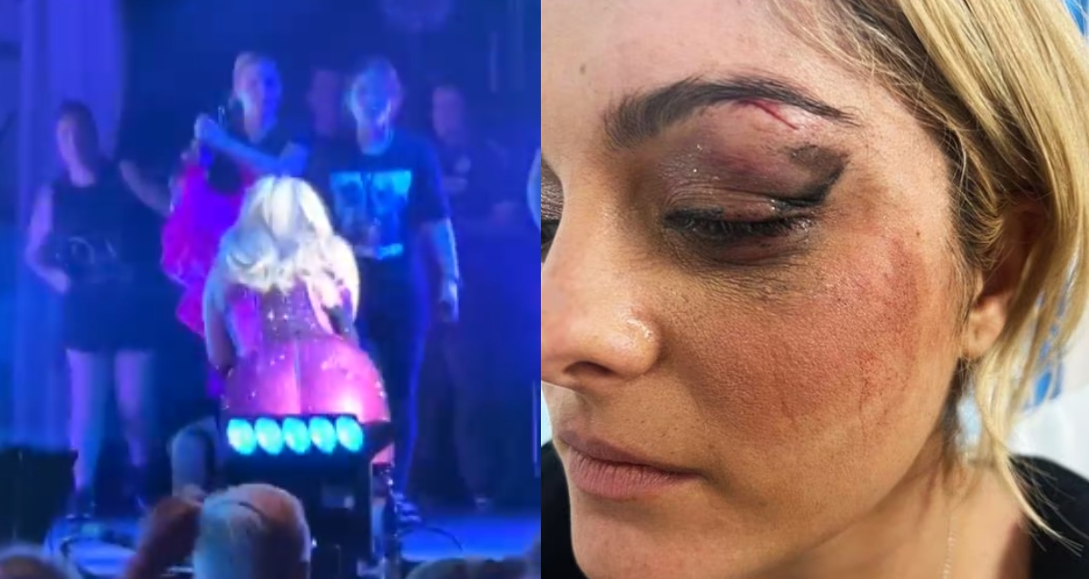 FOTOS: Bebe Rexha abandona el escenario tras ser golpeada por un fanático 