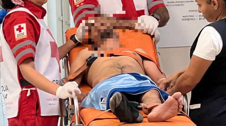 El hombre fue atendido por paramédicos de la Cruz Roja y trasladado a un hospital de Monclova.