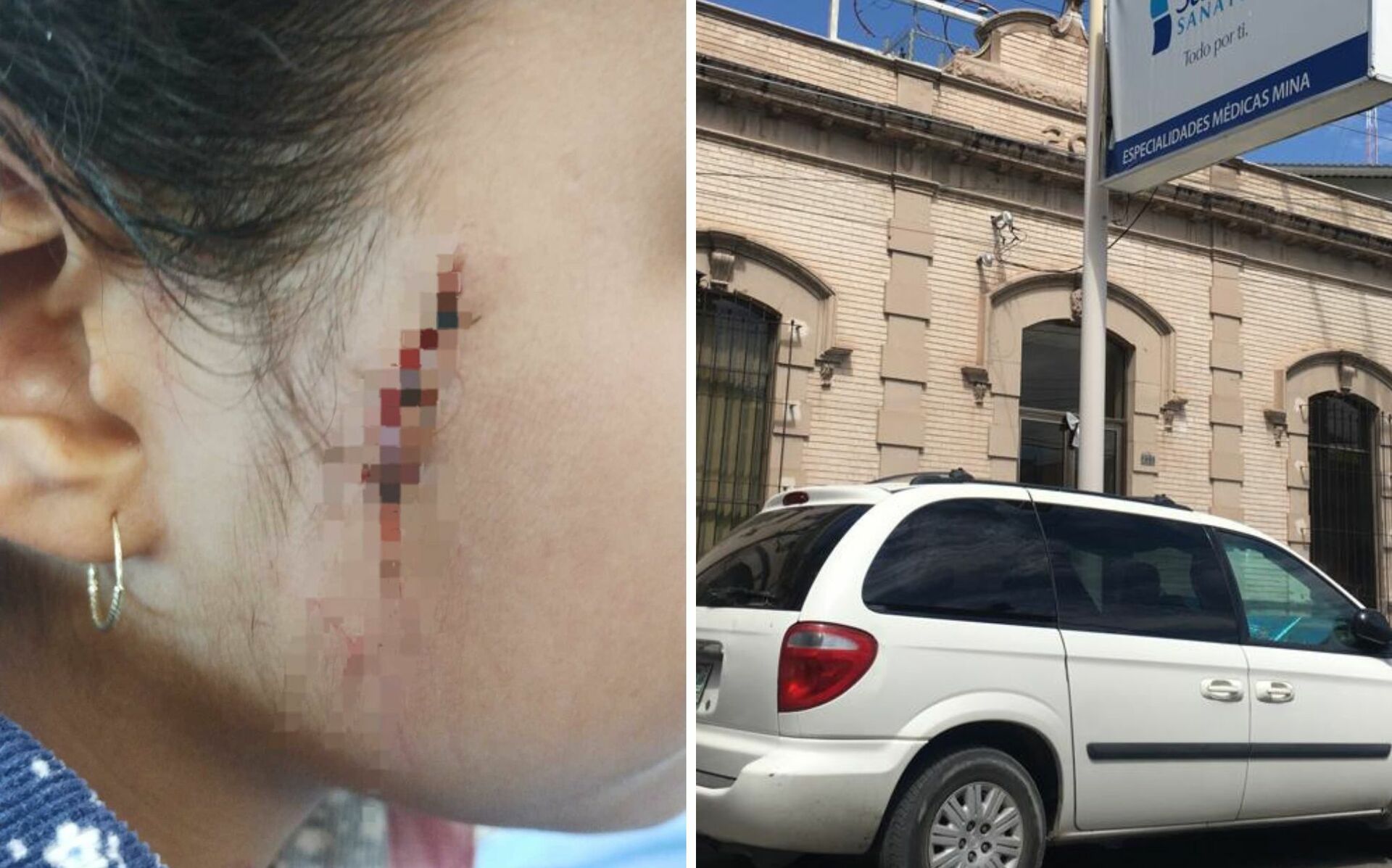 Niña de 9 años llega a un hospital de Gómez Palacio con una herida en el rostro