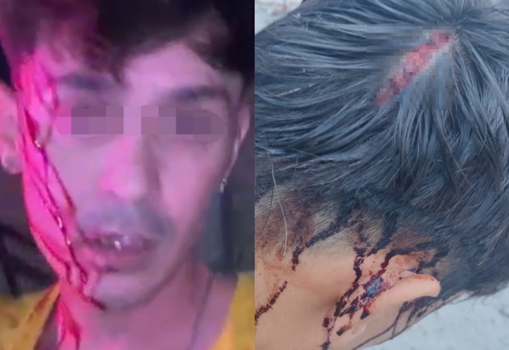 Joven denuncia agresión de parte de agentes viales de Torreón