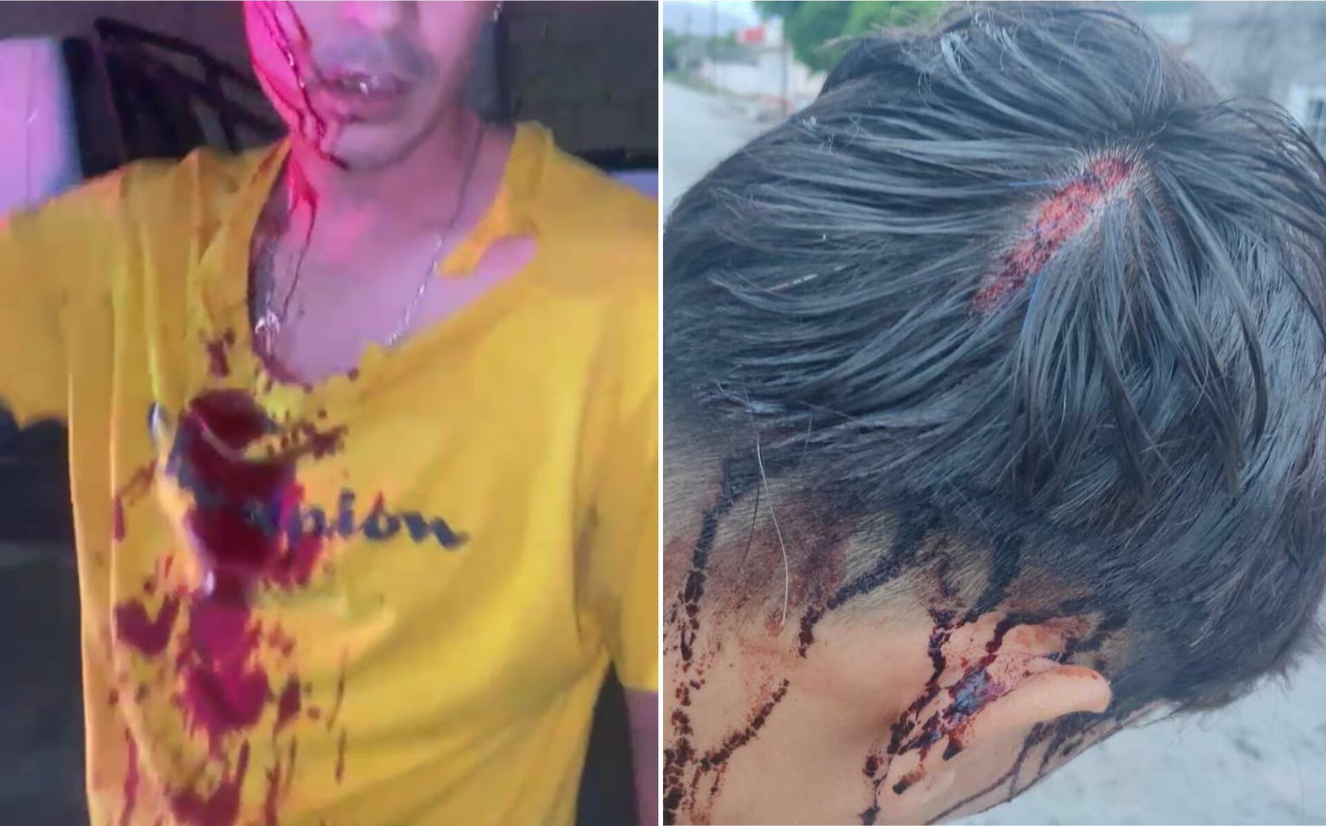 Joven denuncia agresión por parte de un agente vial en Torreón