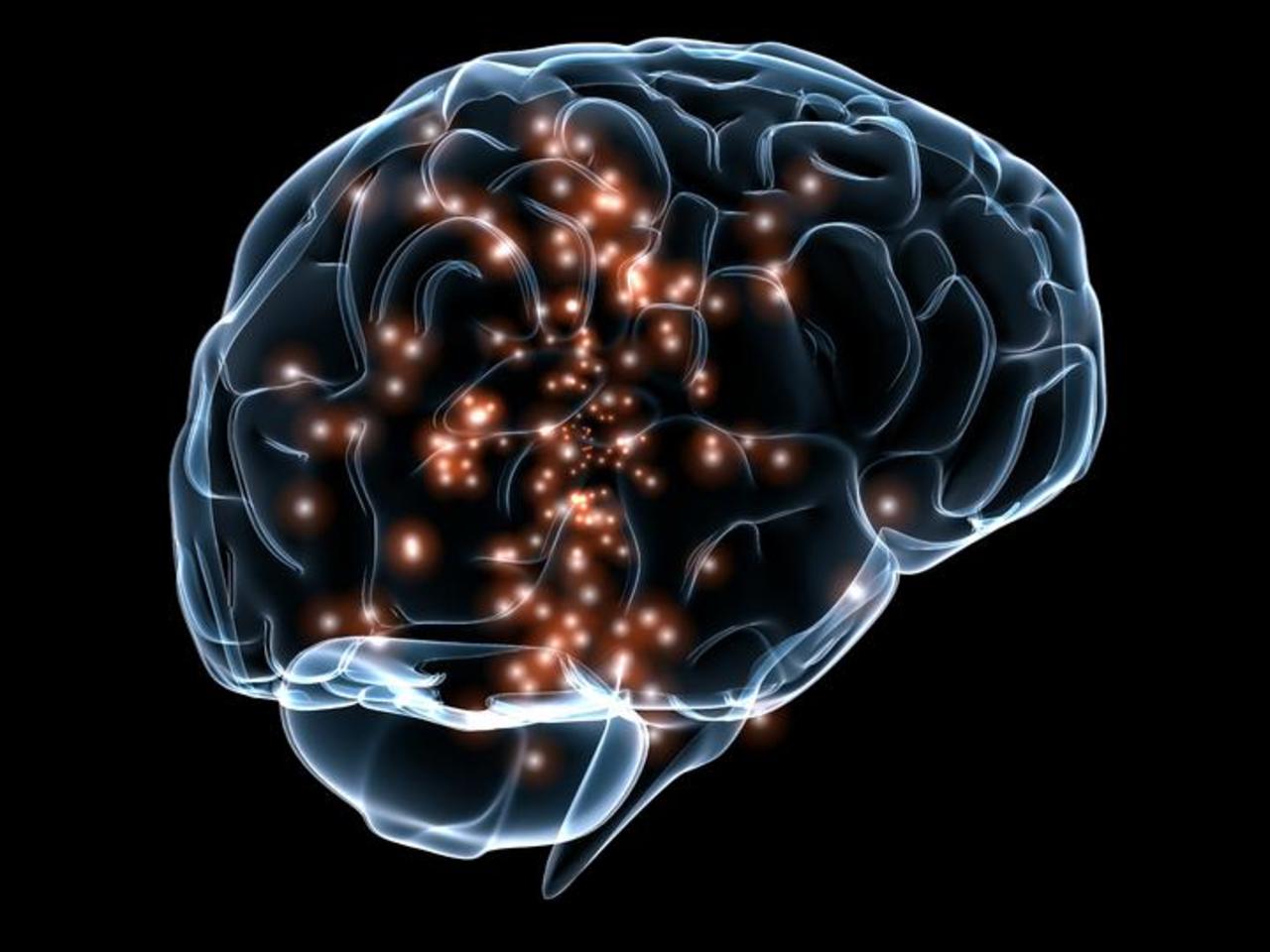 Un implante cerebral puede mejorar algunas funciones cognitivas tras una lesión traumática