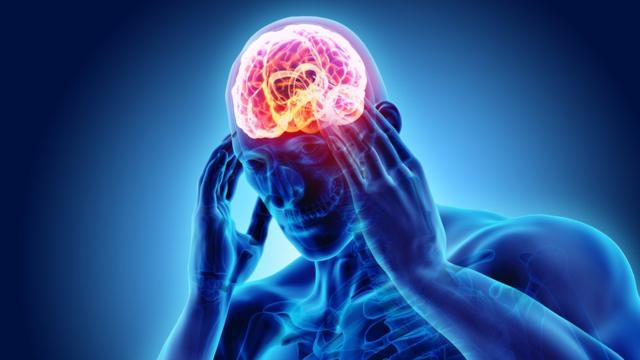 10 tips para terminar con la cefalea, según expertos en neurología